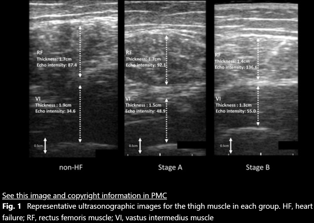 Representative ultrasonographic images for the thigh muscle — BMC Geriatrics 2024
